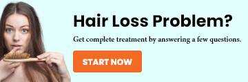 Hair loss prevention and natural remedies: evidence based solutions