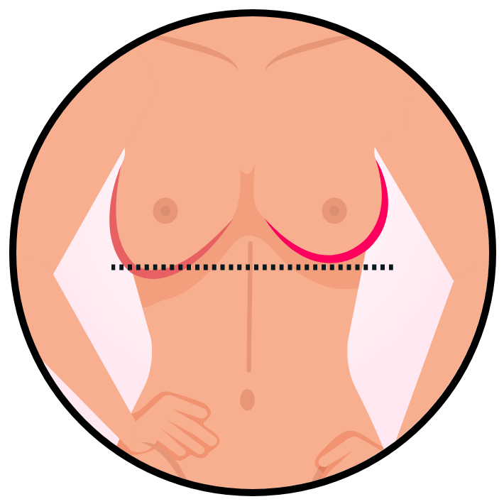 Uplifted curves illustration
