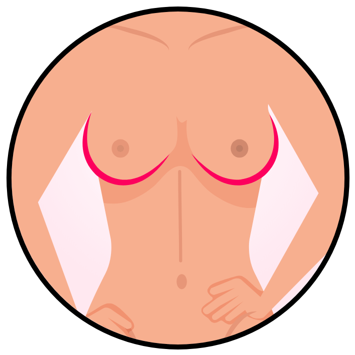 Skin texture improvement illustration